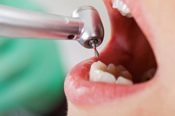 Best Emergency Orthodontic Repairs in Boonville, MO
